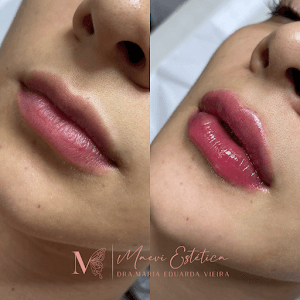 Vida Estética & Saúde - foto 4