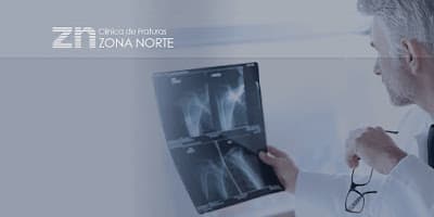 Clínica de Fraturas Zona Norte em null