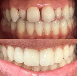 DRA.EMILIA CRISTINA/ PROFESSORA ESPECIALISTA EM HARMONIZAÇÃO FACIAL E ODONTOLOGIA SÃO PAULO em null