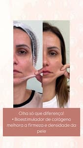 Essenza Estética Avançada - Santana em null