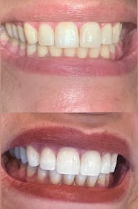 Dra Giulia Augustineli - Dentista em Santana/zona norte sp em null