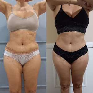 Pós Operatório e Drenagem Linfática - Dra Fernanda Bertoldo CRBM: 46954 em null