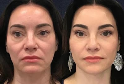 Harmonia Facial São Paulo em null