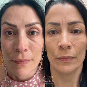 Estética Facial Avançada - Dra Carol Rosa - Rejuvenescimento Facial em null